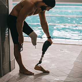 Artificial Limbs